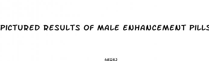 pictured results of male enhancement pills