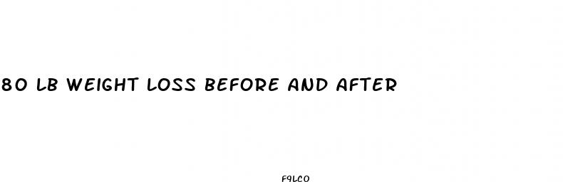 80 lb weight loss before and after