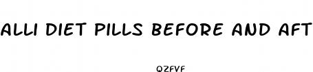 alli diet pills before and after