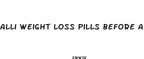 alli weight loss pills before and after