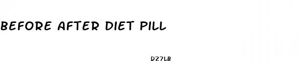 before after diet pill