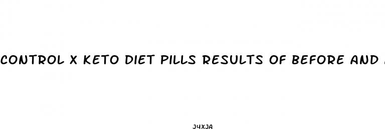 control x keto diet pills results of before and after