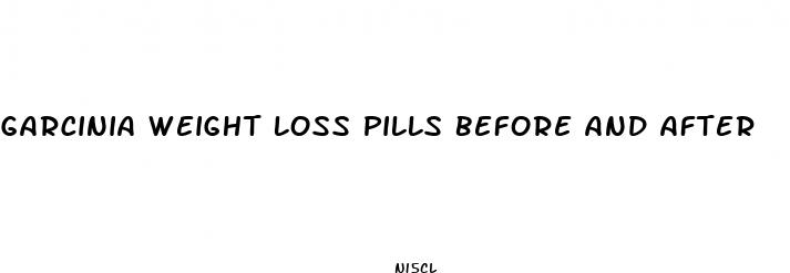 garcinia weight loss pills before and after