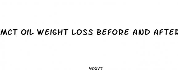 mct oil weight loss before and after