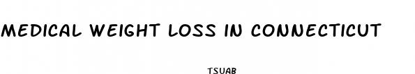 medical weight loss in connecticut