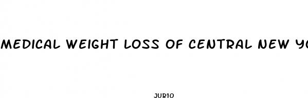 medical weight loss of central new york