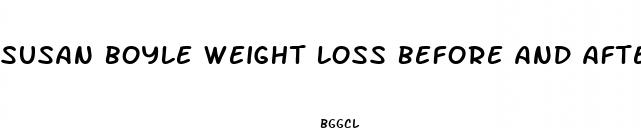 susan boyle weight loss before and after