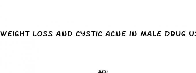 weight loss and cystic acne in male drug use