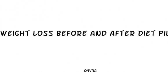 weight loss before and after diet pills