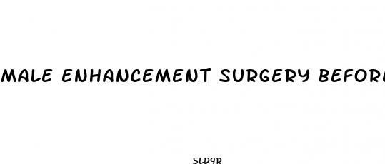 male enhancement surgery before and after