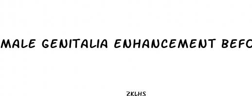 male genitalia enhancement before and after