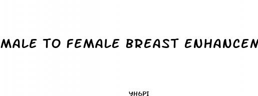 male to female breast enhancement
