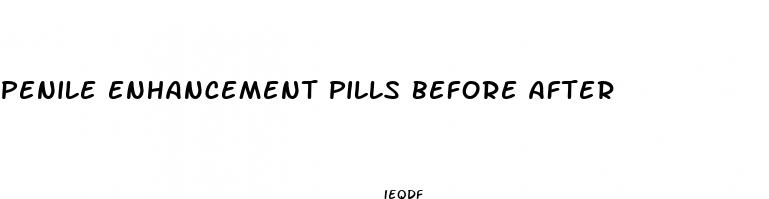 penile enhancement pills before after