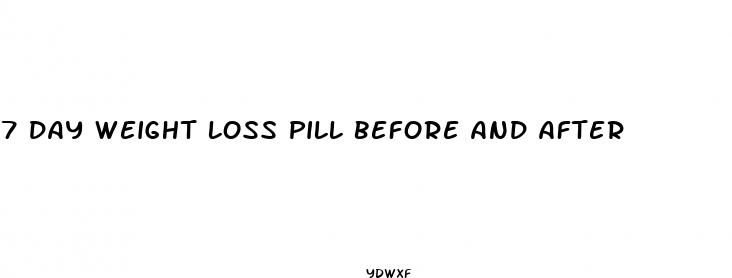 7 day weight loss pill before and after