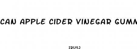 can apple cider vinegar gummies help with weight loss