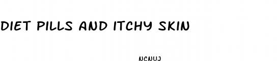 diet pills and itchy skin
