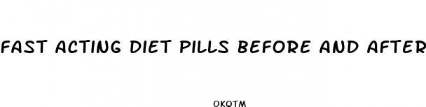 fast acting diet pills before and after