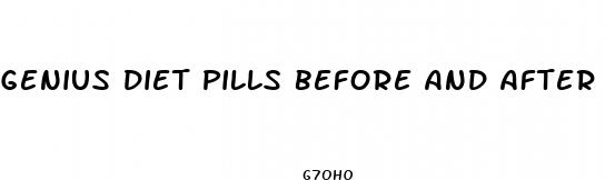 genius diet pills before and after