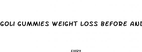 goli gummies weight loss before and after