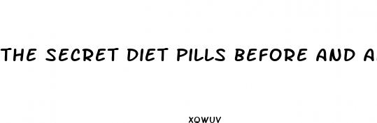 the secret diet pills before and after