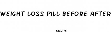 weight loss pill before after