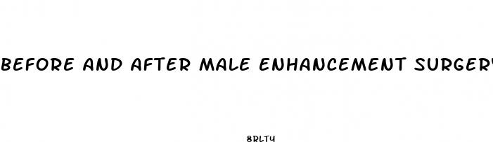 before and after male enhancement surgery