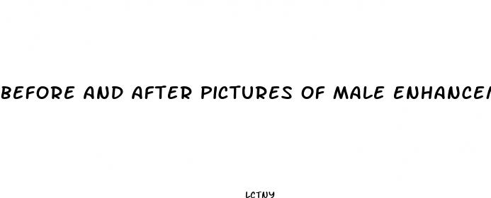 before and after pictures of male enhancement pills