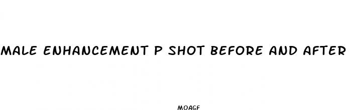 male enhancement p shot before and after