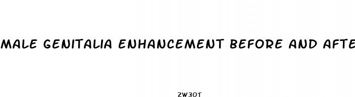 male genitalia enhancement before and after