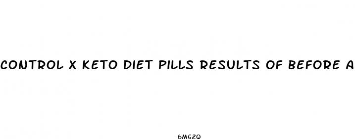 control x keto diet pills results of before and after