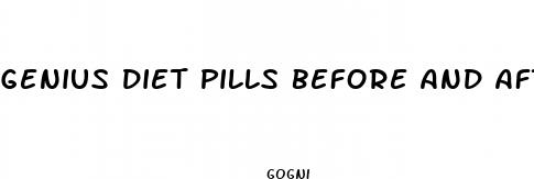genius diet pills before and after