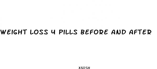 weight loss 4 pills before and after