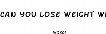 can you lose weight with gummies